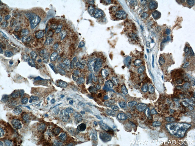 STXBP2 Antibody in Immunohistochemistry (Paraffin) (IHC (P))