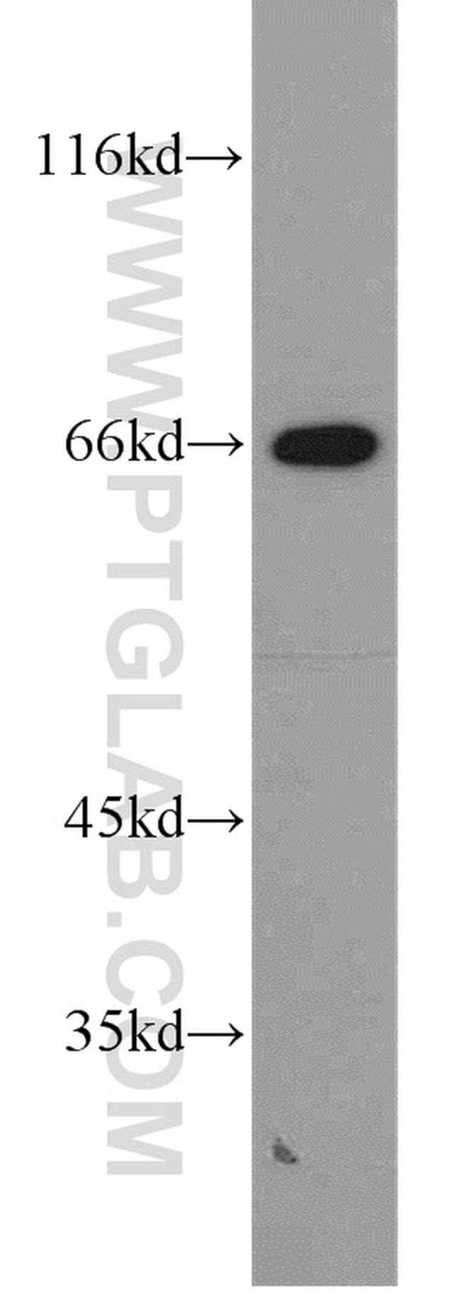 STXBP2 Antibody in Western Blot (WB)