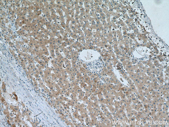 SLC25A15 Antibody in Immunohistochemistry (Paraffin) (IHC (P))