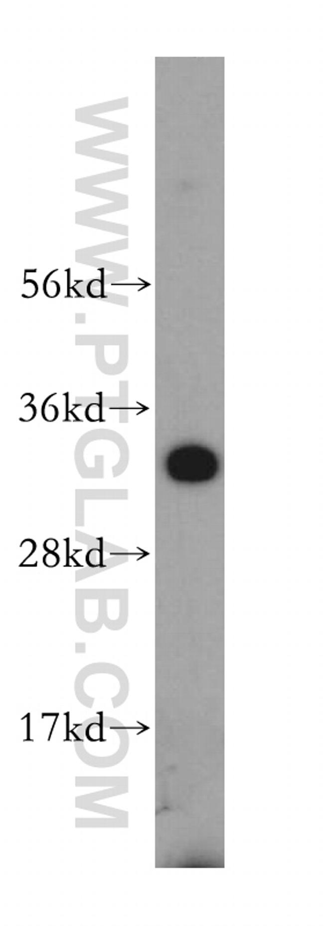 SLC25A15 Antibody in Western Blot (WB)