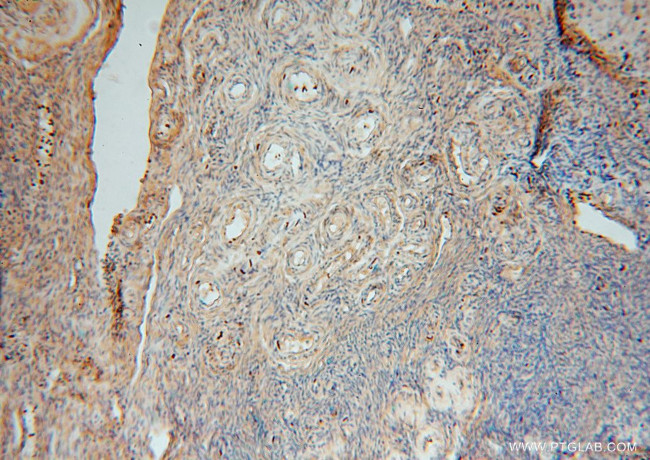 SLC25A15 Antibody in Immunohistochemistry (Paraffin) (IHC (P))