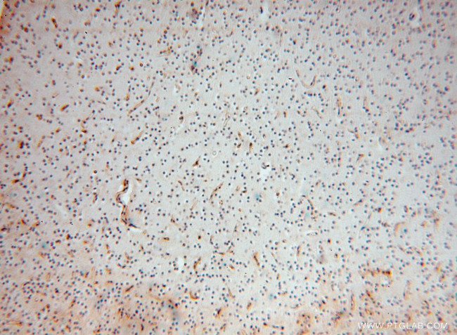 SLC25A15 Antibody in Immunohistochemistry (Paraffin) (IHC (P))