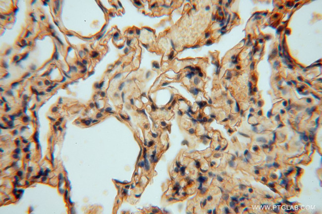 SLC25A15 Antibody in Immunohistochemistry (Paraffin) (IHC (P))