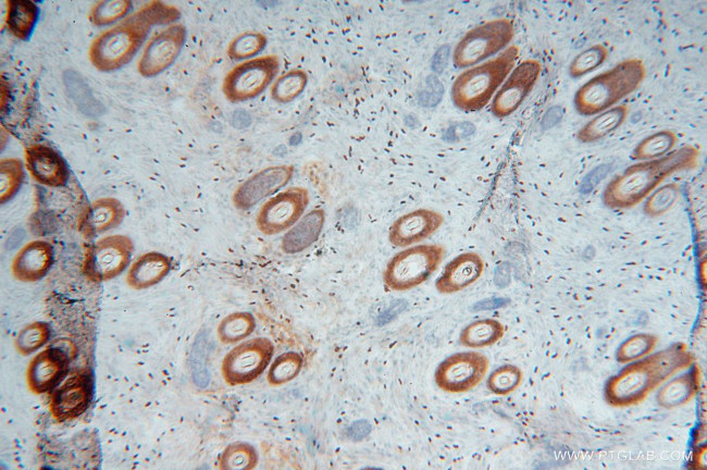 SLC25A15 Antibody in Immunohistochemistry (Paraffin) (IHC (P))