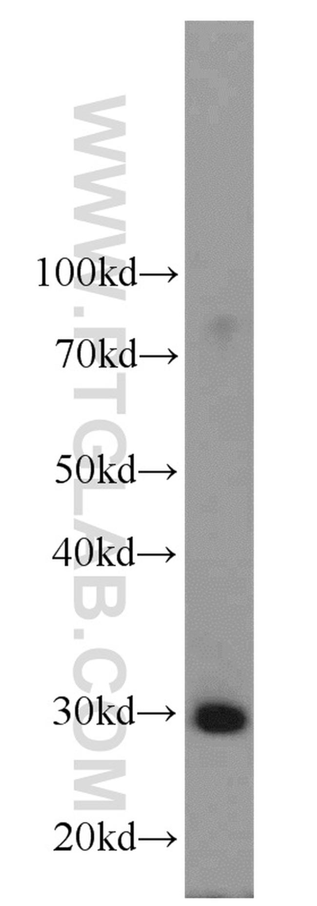 SLC25A15 Antibody in Western Blot (WB)