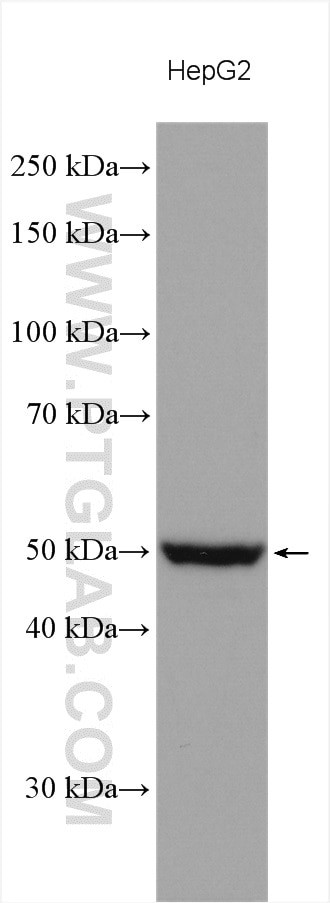 PI4K2A Antibody in Western Blot (WB)