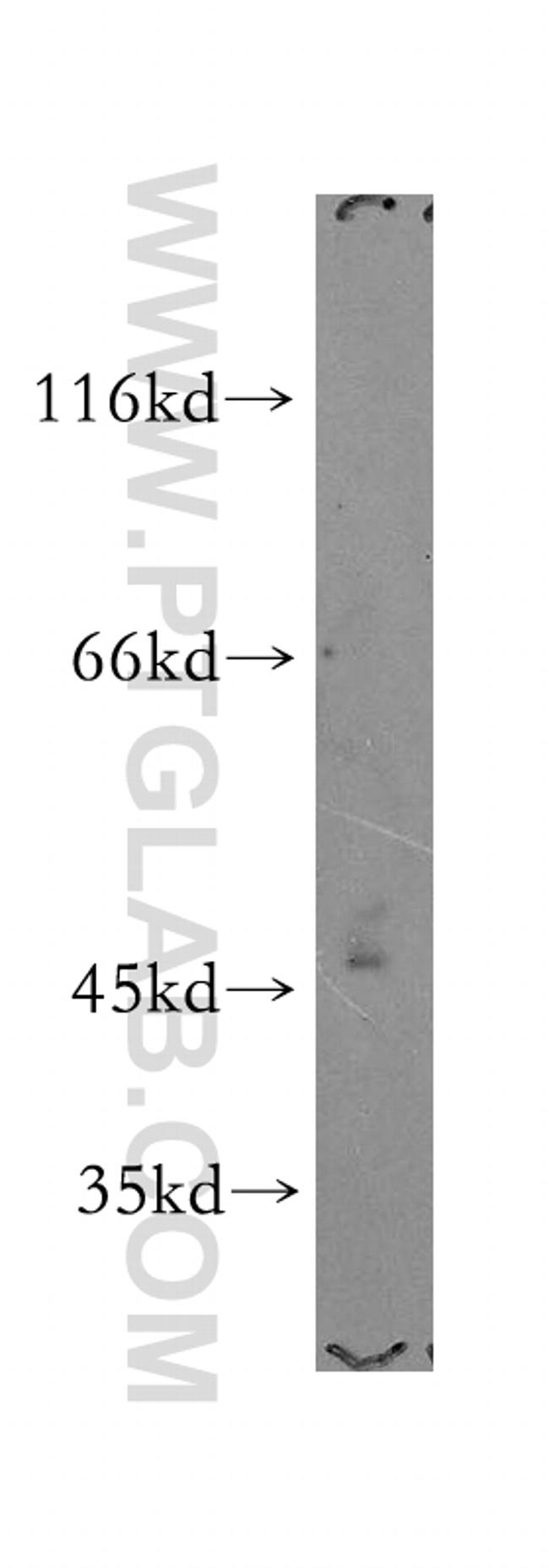 PI4K2A Antibody in Western Blot (WB)