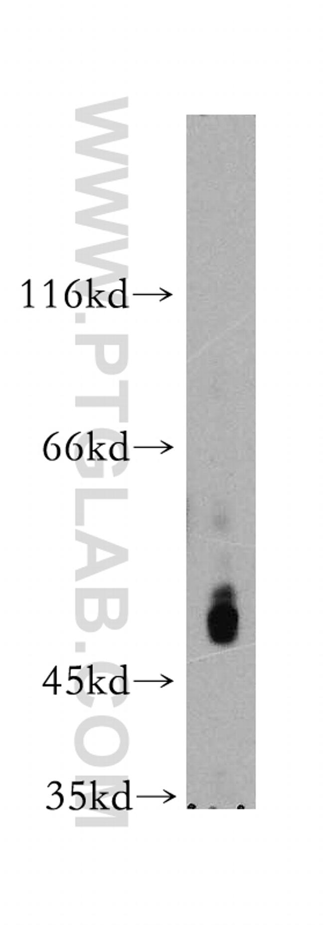 PI4K2A Antibody in Western Blot (WB)