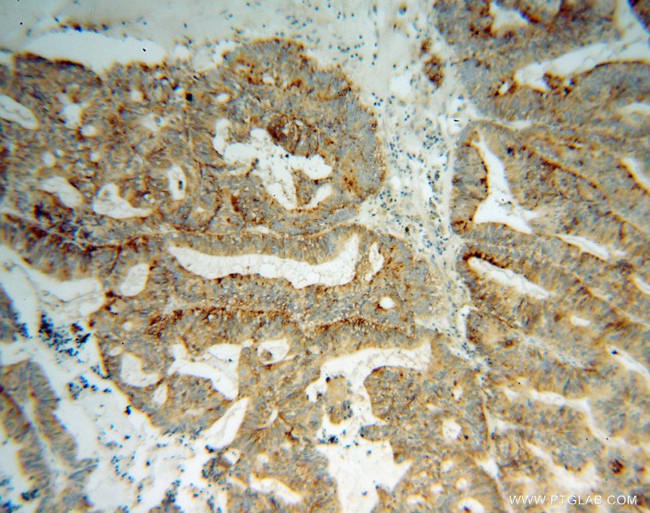 AP3S2 Antibody in Immunohistochemistry (Paraffin) (IHC (P))