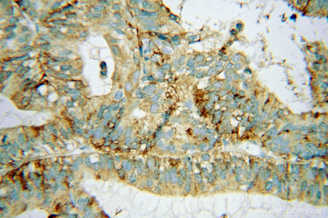 AP3S2 Antibody in Immunohistochemistry (Paraffin) (IHC (P))