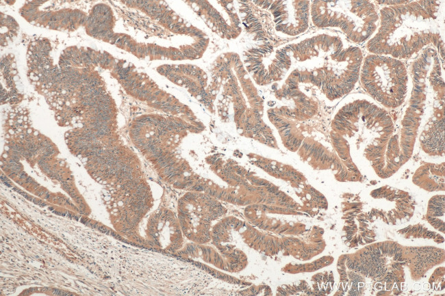 AP3S2 Antibody in Immunohistochemistry (Paraffin) (IHC (P))