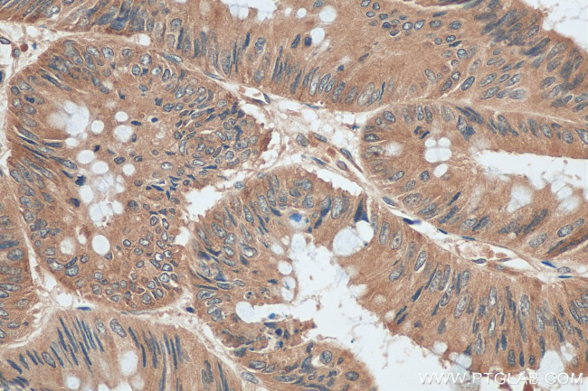 AP3S2 Antibody in Immunohistochemistry (Paraffin) (IHC (P))