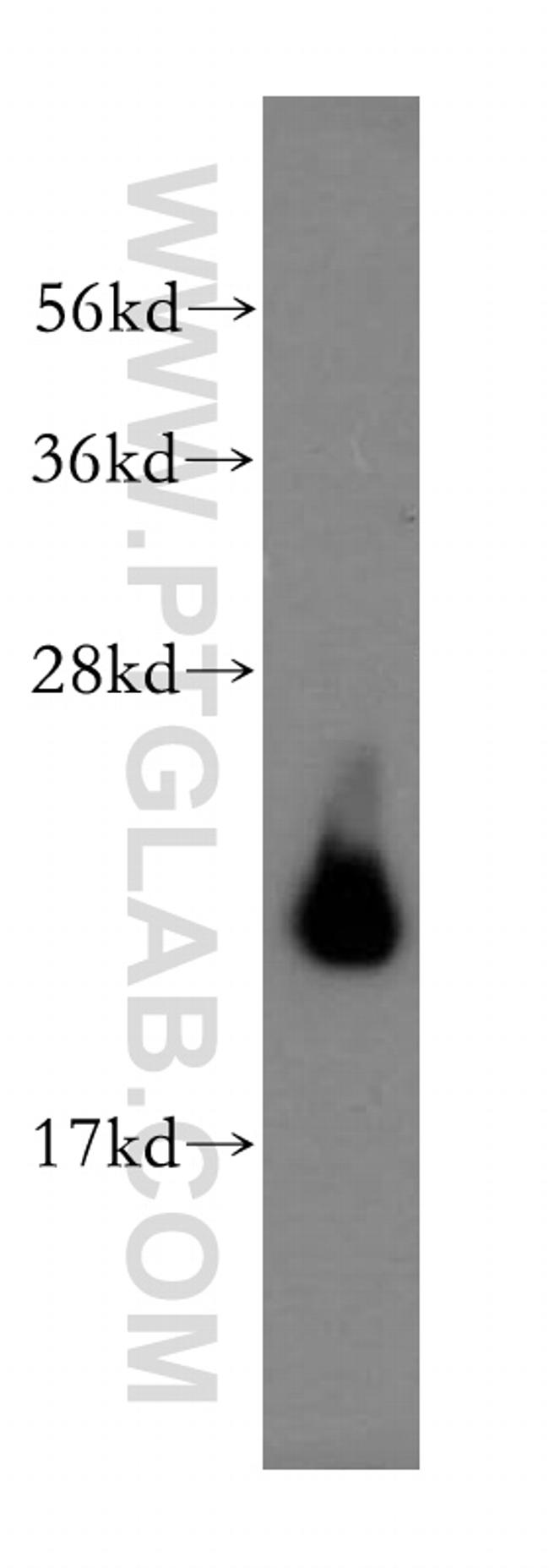 AP3S2 Antibody in Western Blot (WB)