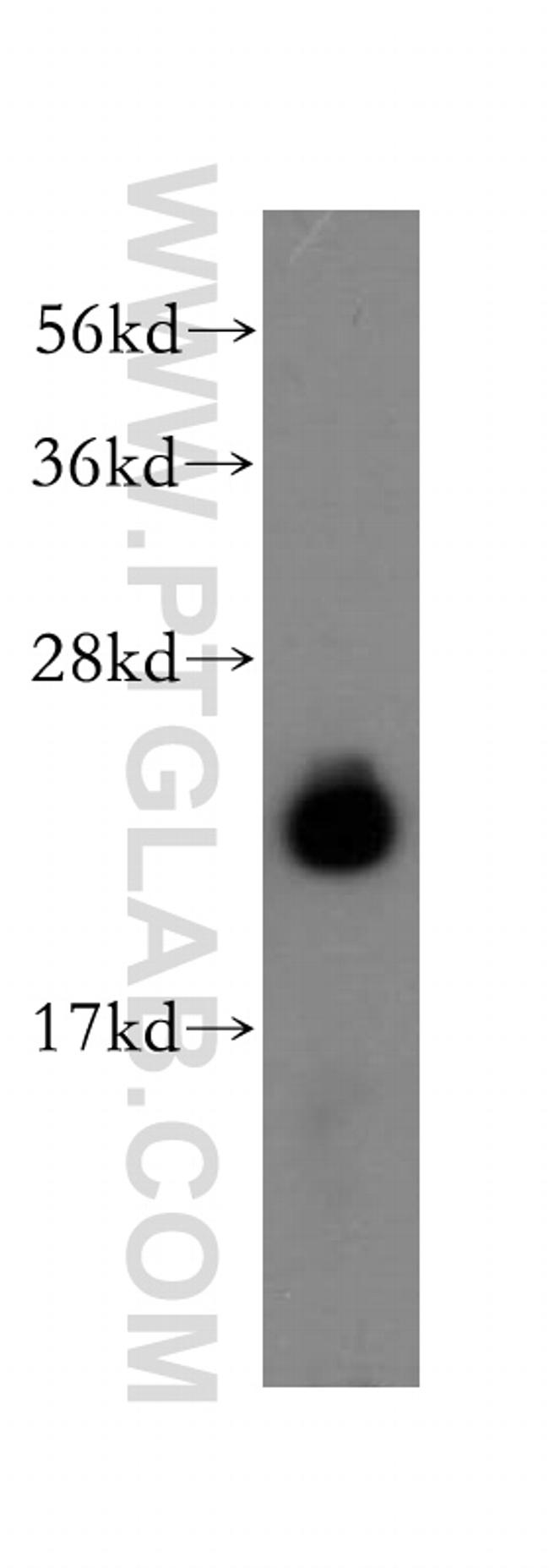 AP3S2 Antibody in Western Blot (WB)