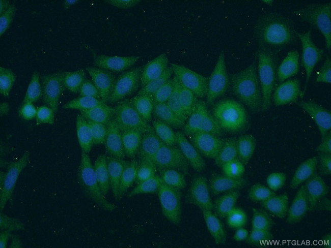 TNFAIP1 Antibody in Immunocytochemistry (ICC/IF)