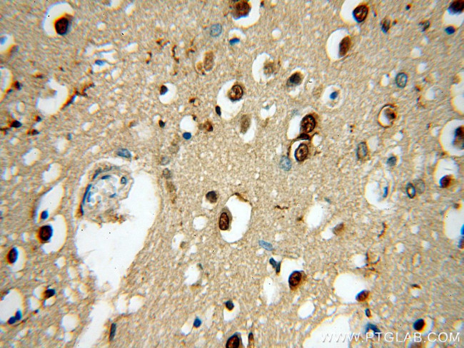 TNFAIP1 Antibody in Immunohistochemistry (Paraffin) (IHC (P))