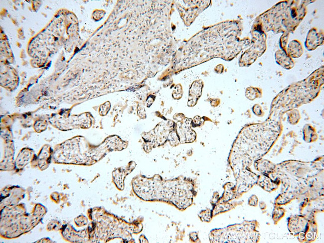 TNFAIP1 Antibody in Immunohistochemistry (Paraffin) (IHC (P))