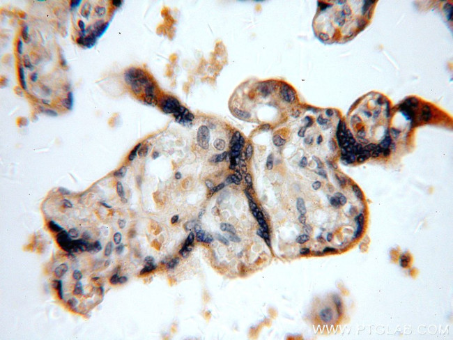 TNFAIP1 Antibody in Immunohistochemistry (Paraffin) (IHC (P))