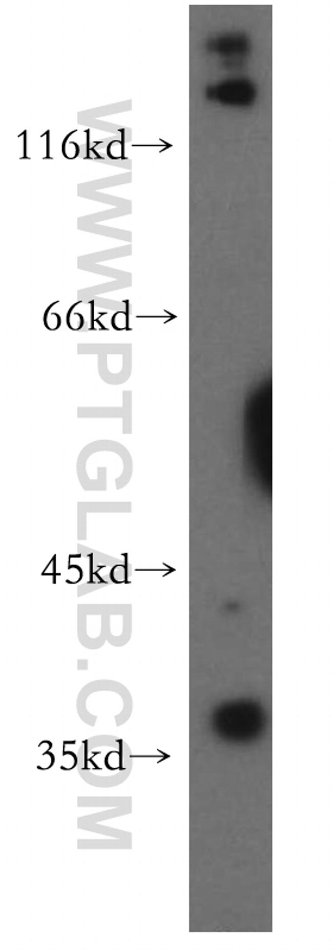 TNFAIP1 Antibody in Western Blot (WB)