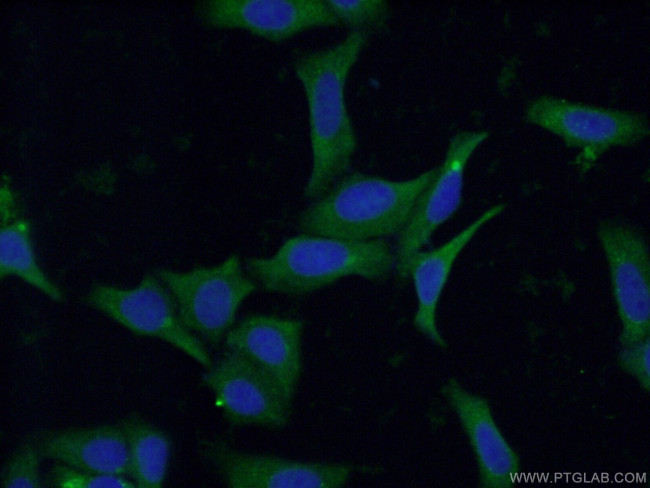 STT3B Antibody in Immunocytochemistry (ICC/IF)