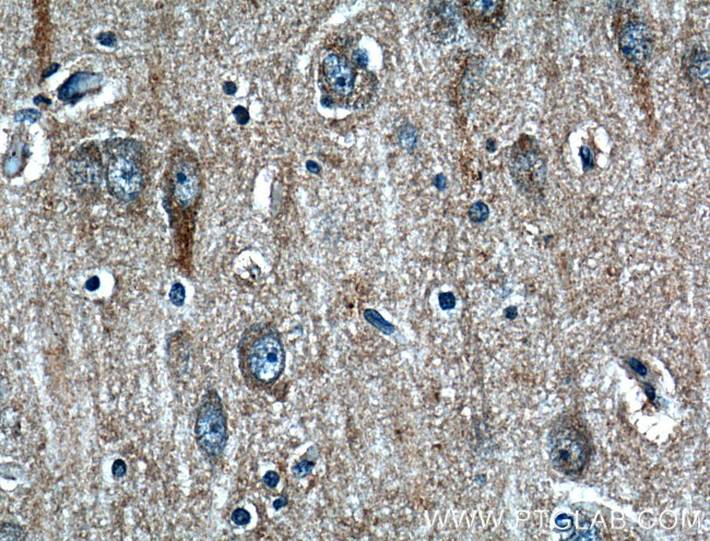 STT3B Antibody in Immunohistochemistry (Paraffin) (IHC (P))