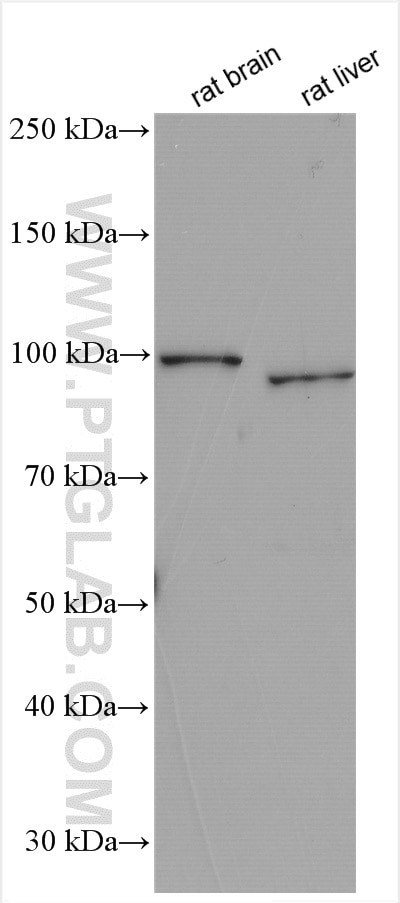 STT3B Antibody in Western Blot (WB)