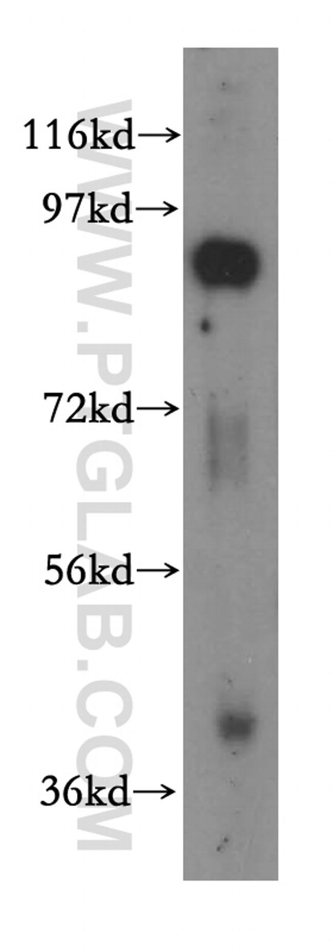 STT3B Antibody in Western Blot (WB)