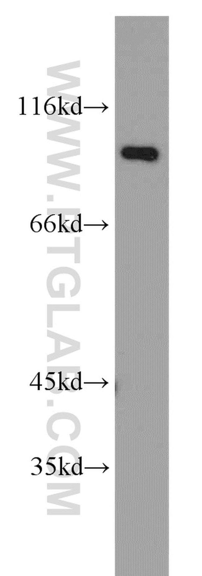 STT3B Antibody in Western Blot (WB)