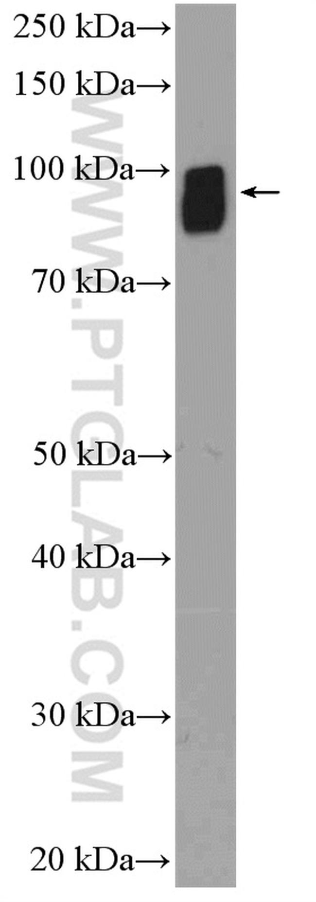 STT3B Antibody in Western Blot (WB)