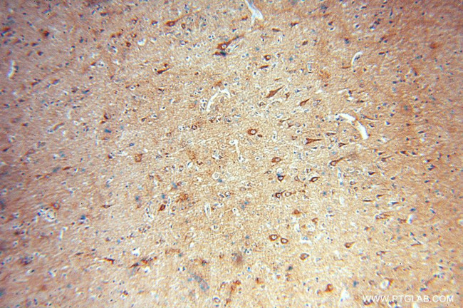 SCAMP1 Antibody in Immunohistochemistry (Paraffin) (IHC (P))