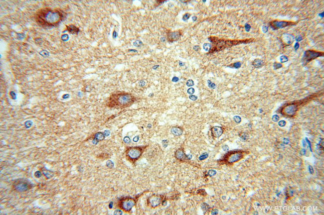 SCAMP1 Antibody in Immunohistochemistry (Paraffin) (IHC (P))