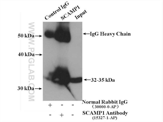 SCAMP1 Antibody in Immunoprecipitation (IP)