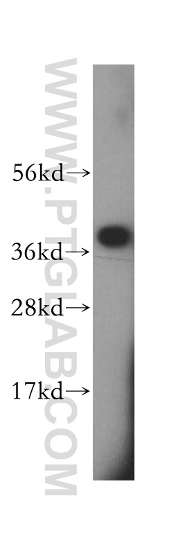 SCAMP1 Antibody in Western Blot (WB)