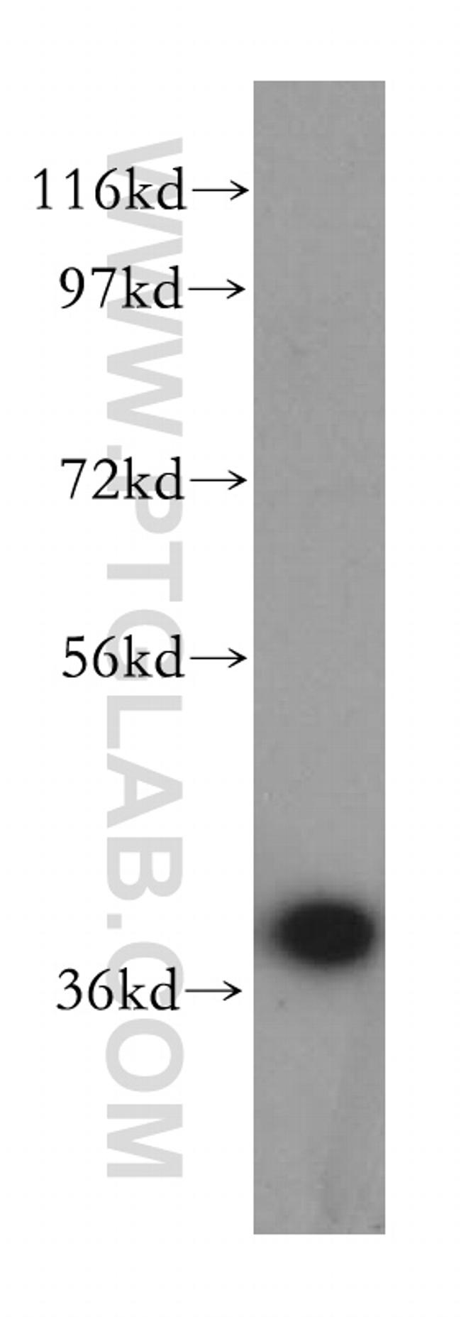 SCAMP1 Antibody in Western Blot (WB)