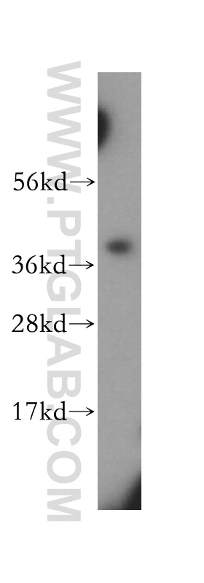 SCAMP1 Antibody in Western Blot (WB)