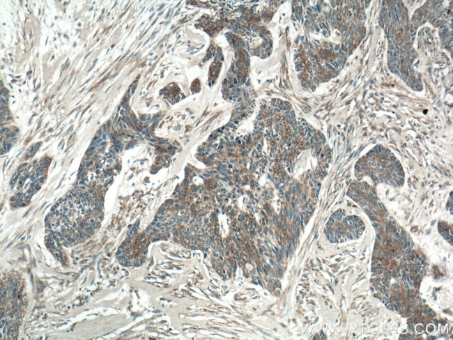 SFRP4 Antibody in Immunohistochemistry (Paraffin) (IHC (P))