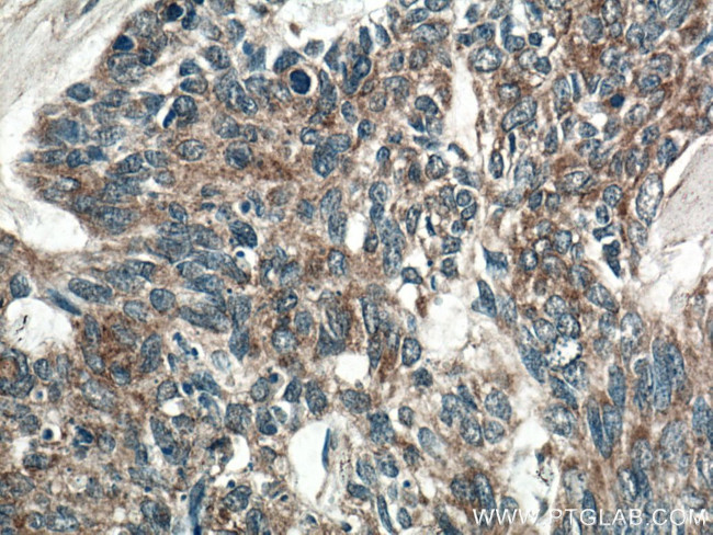 SFRP4 Antibody in Immunohistochemistry (Paraffin) (IHC (P))