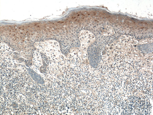 SFRP4 Antibody in Immunohistochemistry (Paraffin) (IHC (P))