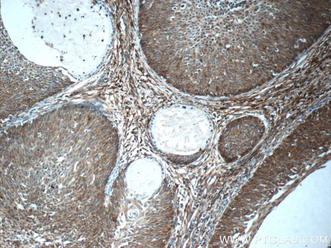 SFRP4 Antibody in Immunohistochemistry (Paraffin) (IHC (P))