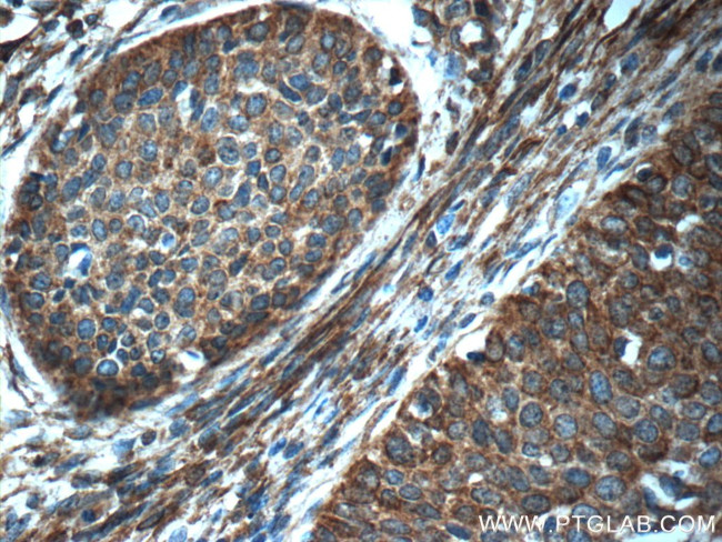 SFRP4 Antibody in Immunohistochemistry (Paraffin) (IHC (P))