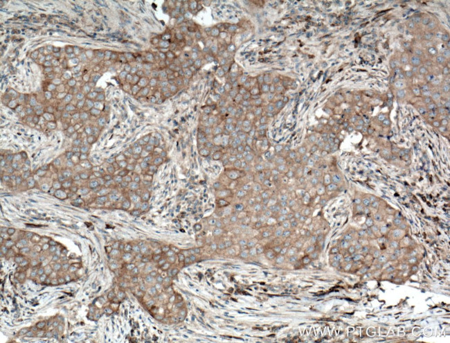 SFRP4 Antibody in Immunohistochemistry (Paraffin) (IHC (P))