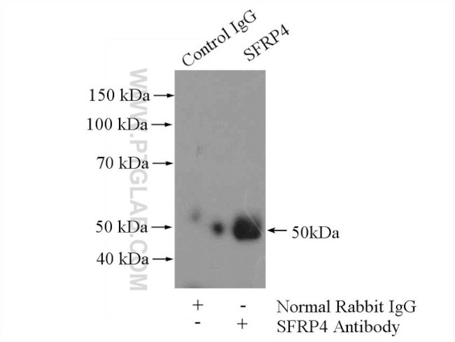 SFRP4 Antibody in Immunoprecipitation (IP)