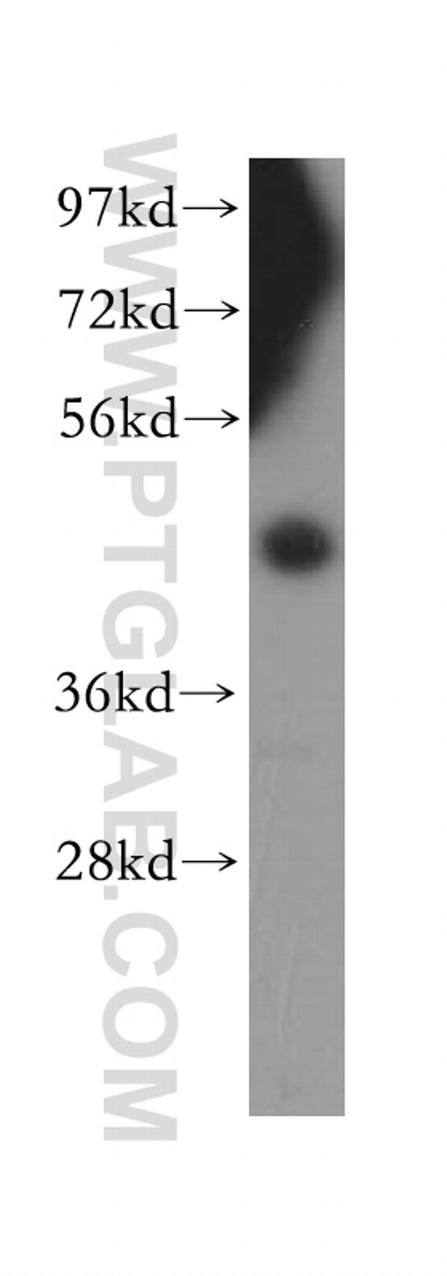 SFRP4 Antibody in Western Blot (WB)