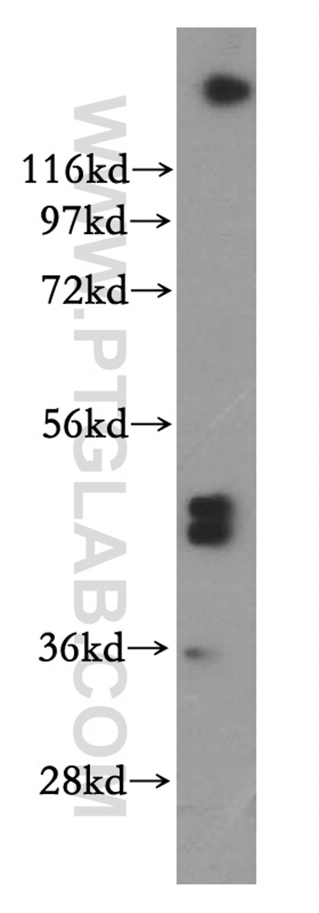 SFRP4 Antibody in Western Blot (WB)