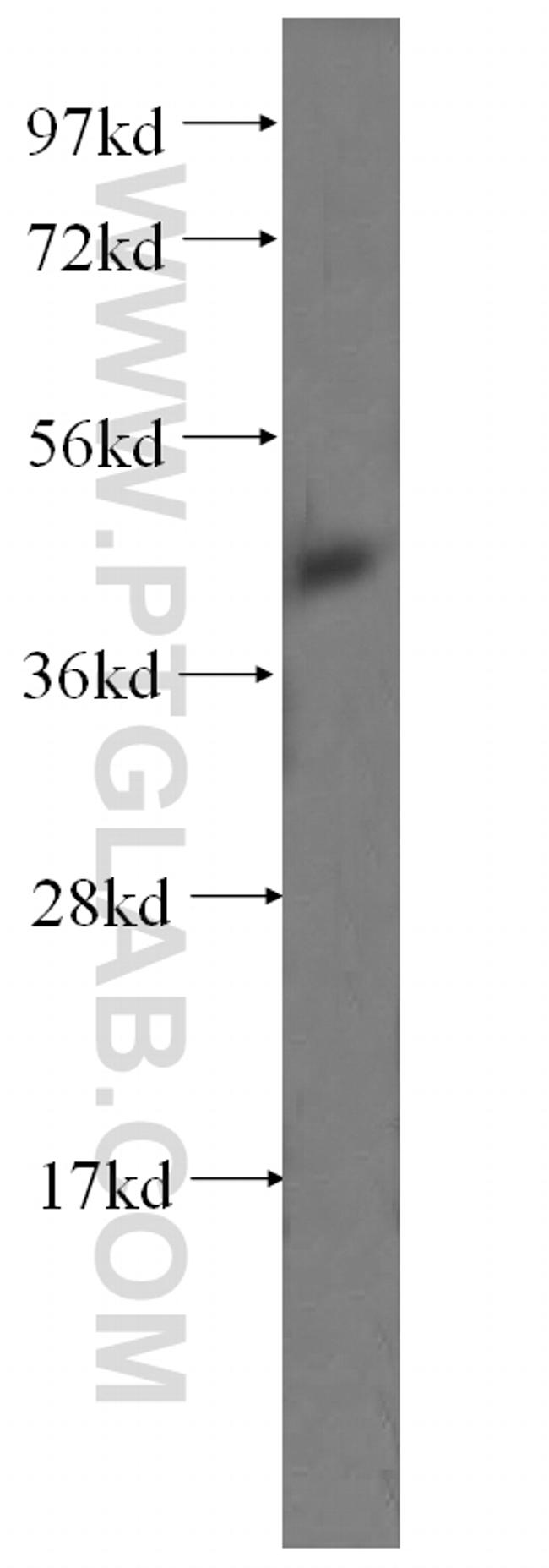 RCL1 Antibody in Western Blot (WB)