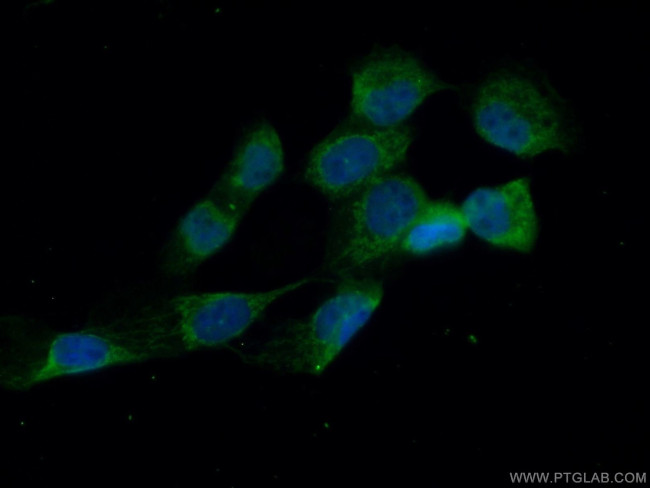 MVD Antibody in Immunocytochemistry (ICC/IF)