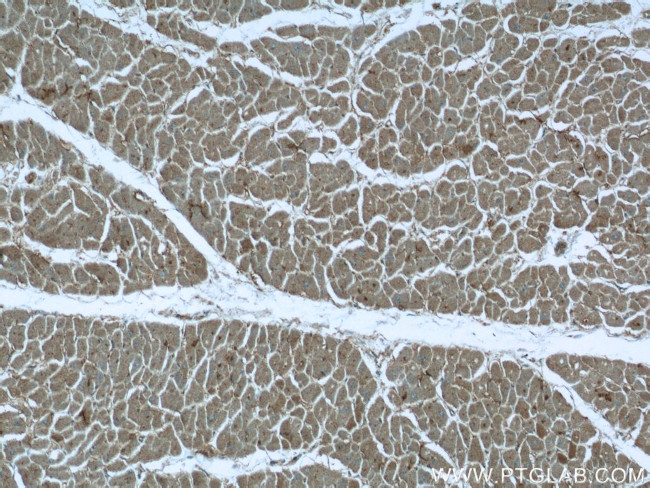 MVD Antibody in Immunohistochemistry (Paraffin) (IHC (P))