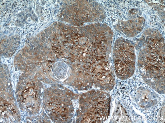 MVD Antibody in Immunohistochemistry (Paraffin) (IHC (P))