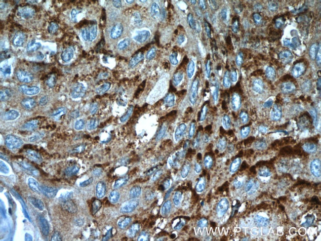 MVD Antibody in Immunohistochemistry (Paraffin) (IHC (P))