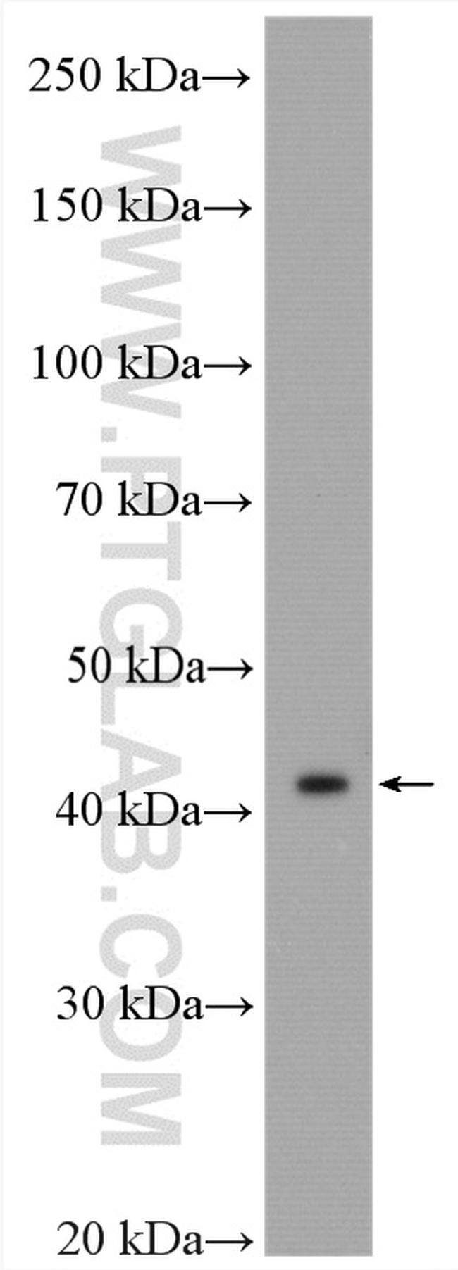 MVD Antibody in Western Blot (WB)